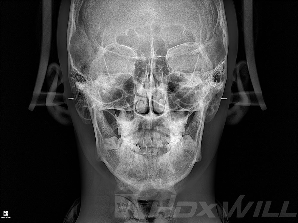 dentri-rx-scan-frontal.jpg