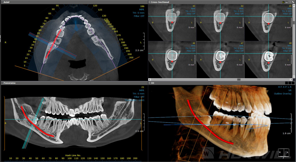 dentri-cirugia-oral.jpg